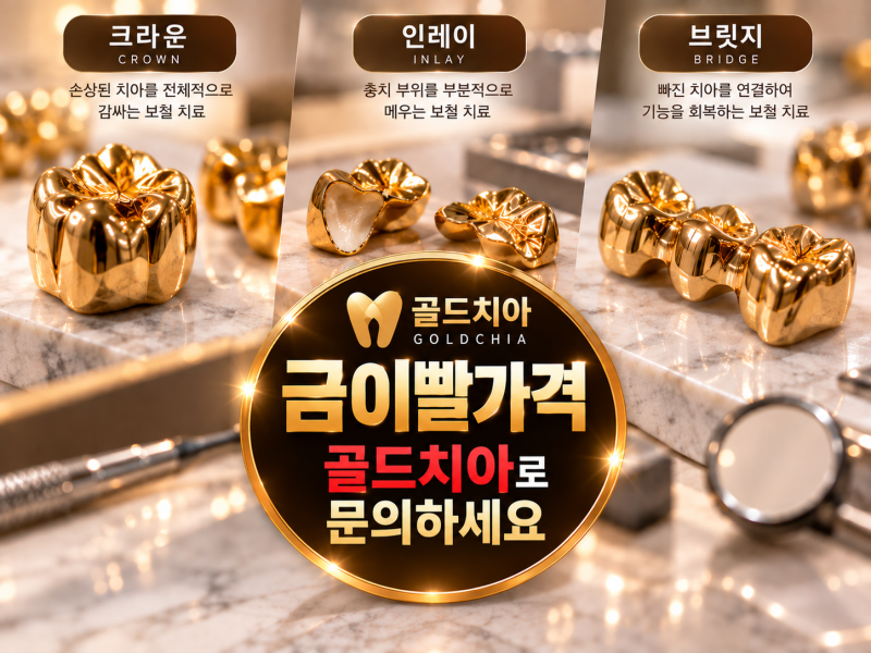 금이빨가격, 금니 하나 팔면 얼마일까? 가격이 달라지는 3가지 이유