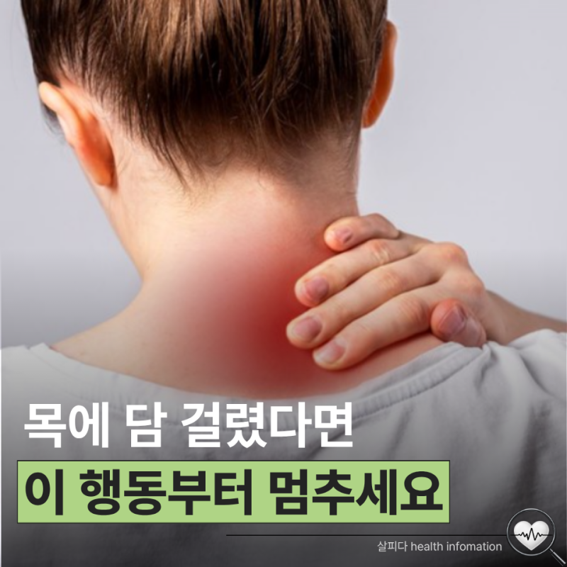 목에 담걸렸을때 무조건 목부터 돌리면 안 되는 이유
