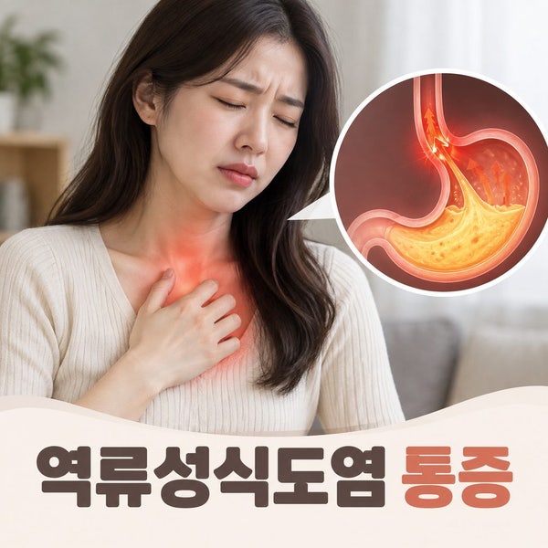 [역류성식도염] 지속적인 속 쓰림, 재발 잦은 역류성식도염 증상. 원인. 약 먹어도 잘 낫지 ....
