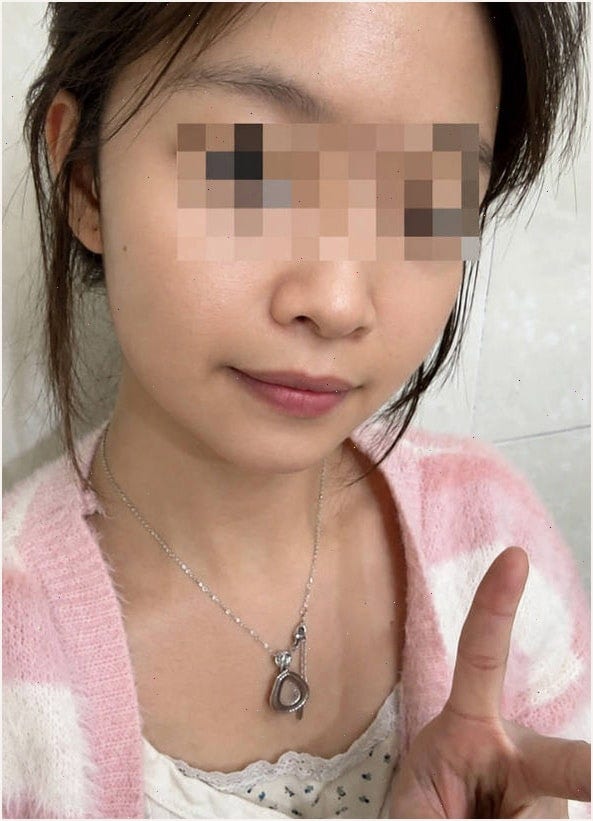 한미 유리아크림 약국 두 달 써보니?