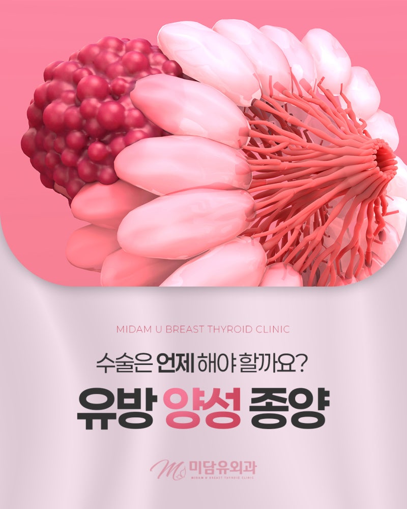 부산 맘모톰 잘하는곳 유방 혹, 무조건 제거해야 할까요?