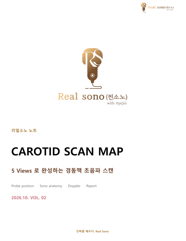 [리얼소노] 경동맥 초음파 (Carotid Artery Ultrasound) 검사, 어떻게 하는 걸까요? 검사 방법부터 측....