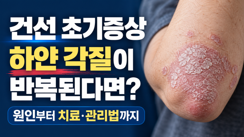 건선 초기증상, 하얀 각질이 반복된다면? 원인부터 치료·관리법까지