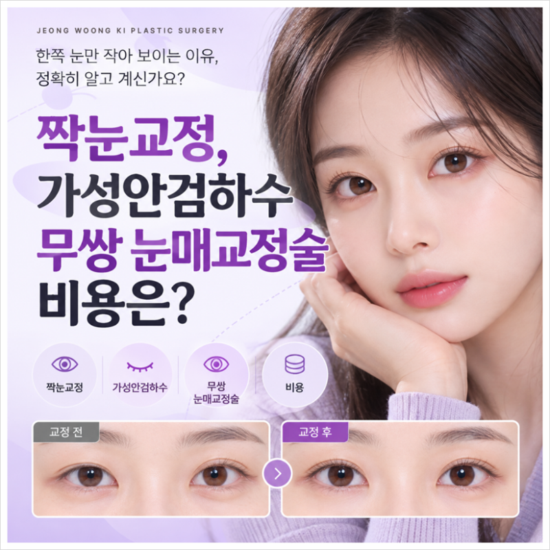 짝눈교정, 가성안검하수 무쌍 눈매교정술 비용은?