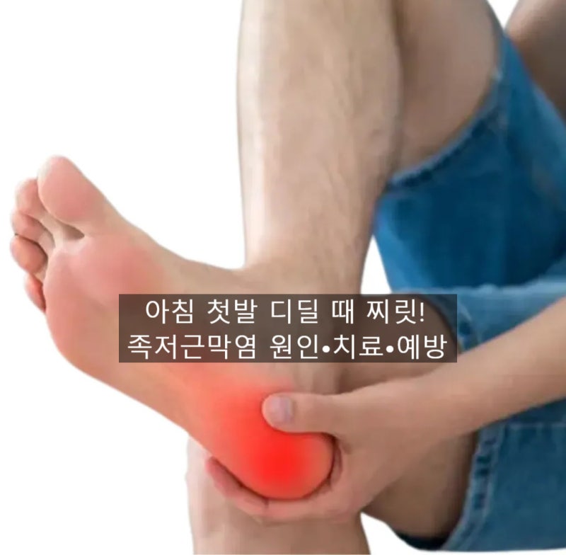 아침 첫발 디딜 때 찌릿! '족저근막염' 초기 치료법과 마사지
