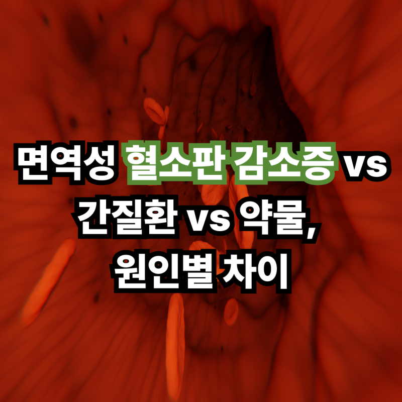 면역성 혈소판 감소증 vs 간질환 vs 약물, 원인별 차이