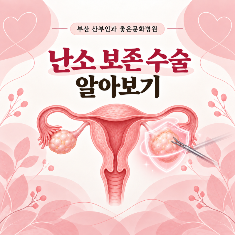 부산 산부인과 좋은문화병원 :: 난소 물혹이 커도 난소를 살릴 수 있을까요? 난소 보존 수술 ....