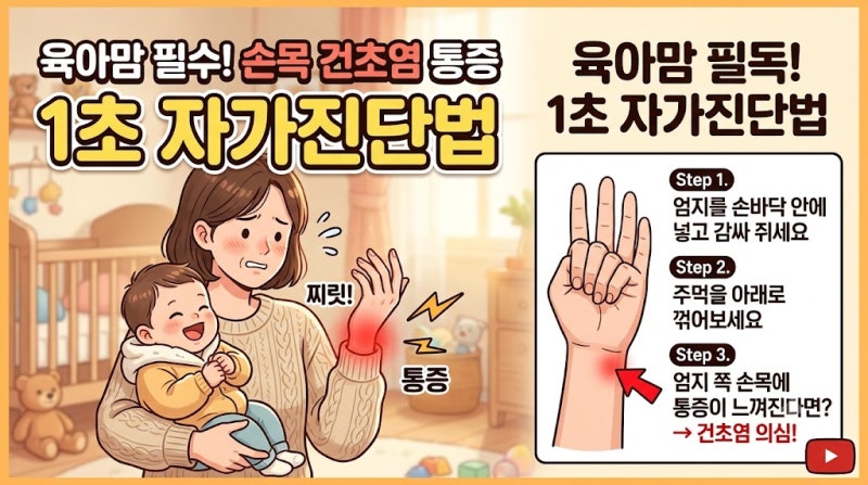 손목 건초염 통증, 육아맘을 위한 1초 자가진단법