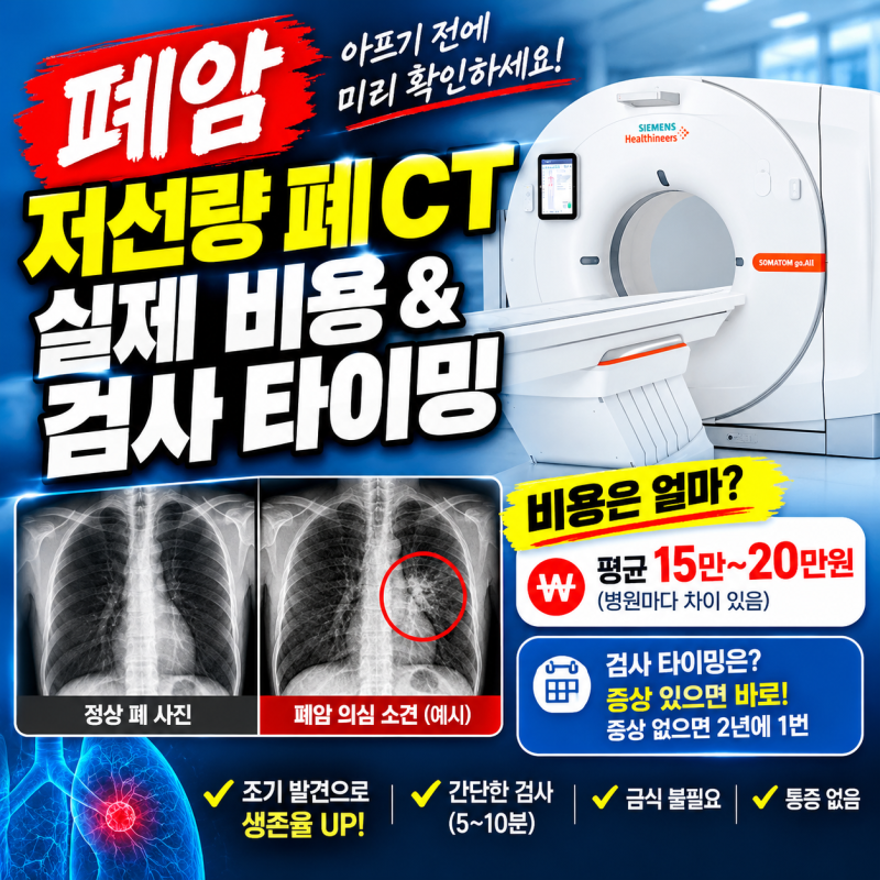 담배 안 피우는 평범한 4050도 폐 CT 꼭 찍어야 할까? 비용과 타이밍 총정리 (엑스레이의 배신)