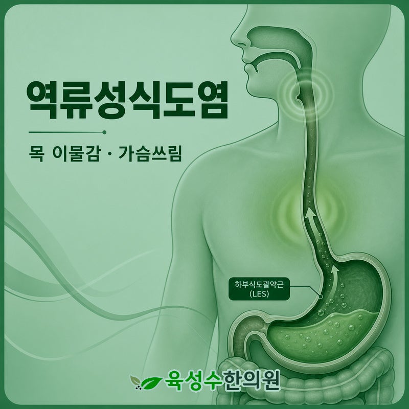 역류성식도염 가슴 통증은 주로 새벽에 나타나 경산 진량