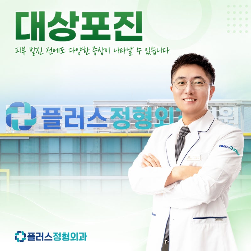 송도 대상포진 잠복기 2주? 잠복기 증상부터 싱그릭스 백신까지 총정리