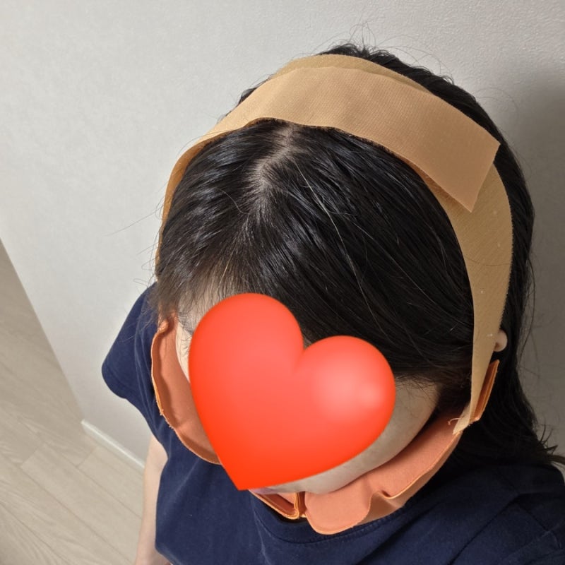 턱 관절 관리 및 얼굴 라인 케어를 위한 턱찜질팩 사용 후기 (O2메디칼 턱찜질팩)