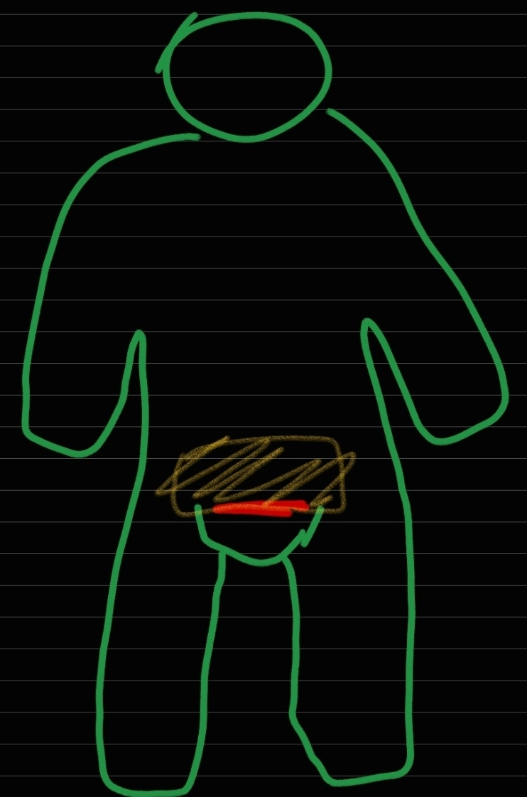 [자궁근종 수술 후기] 수술 15일차까지 상세 후기_노원을지대병원