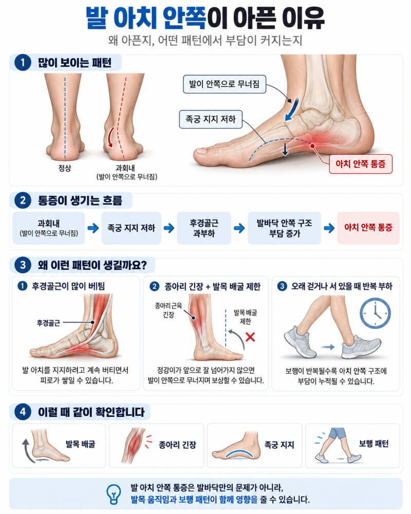 [성복동 발바닥 컨디셔닝] 오래 걸으면 발 아치 안쪽이 아픈 이유