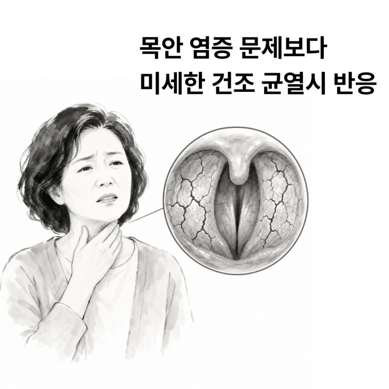 침삼킬때 목이물감 목통증, 역류성식도염 약 소용없을때 원인