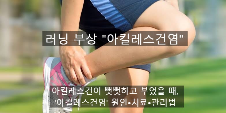 [발목/종아리 부상] 아킬레스건이 뻣뻣하고 부었을 때, '아킬레스건염' 관리법