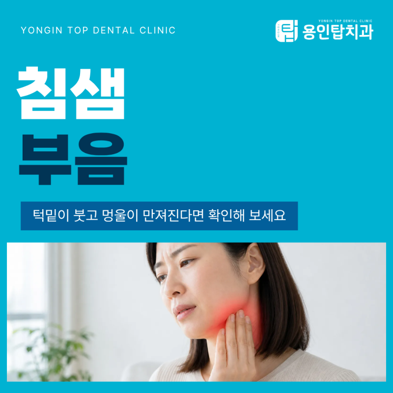 침샘 부음, 턱밑이 붓고 멍울이 만져진다면 확인해 보세요