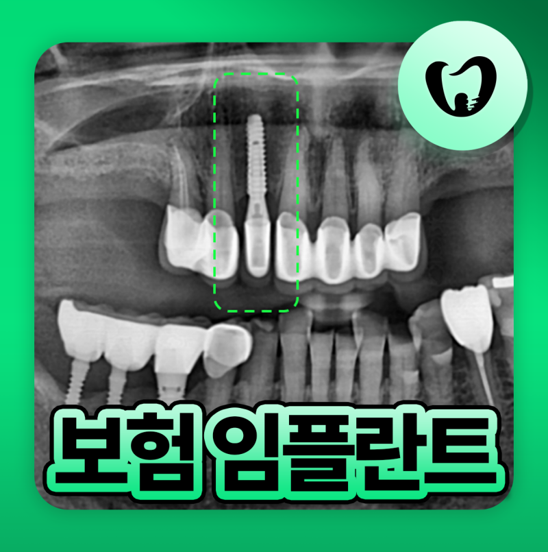 동래치과 임플란트 보험 비용 27년엔 무치악도 가능?
