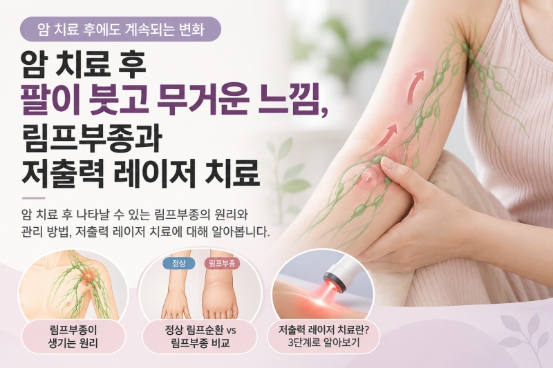 암 치료 후 팔이 붓고 무거운 느낌, 림프부종과 저출력 레이저 치료