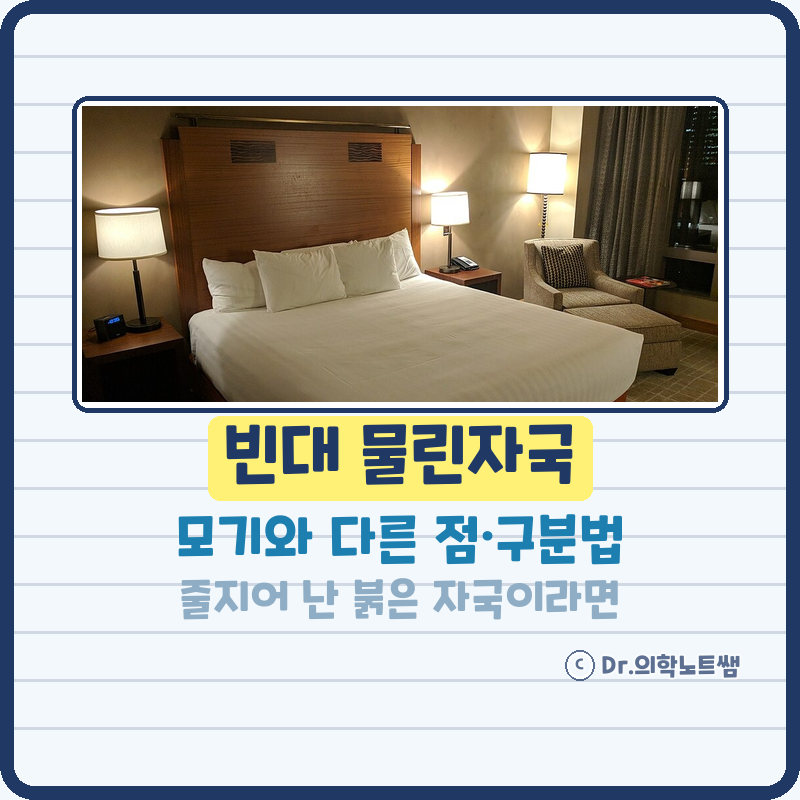 빈대 물린자국 모기와 어떻게 다를까? 베드버그 구분법과 대처