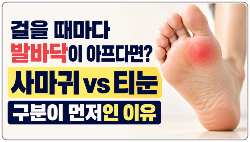 미사역피부과 발바닥이 걸을 때마다 아프다면 사마귀와 티눈 구분하는 것이 먼저인 이유