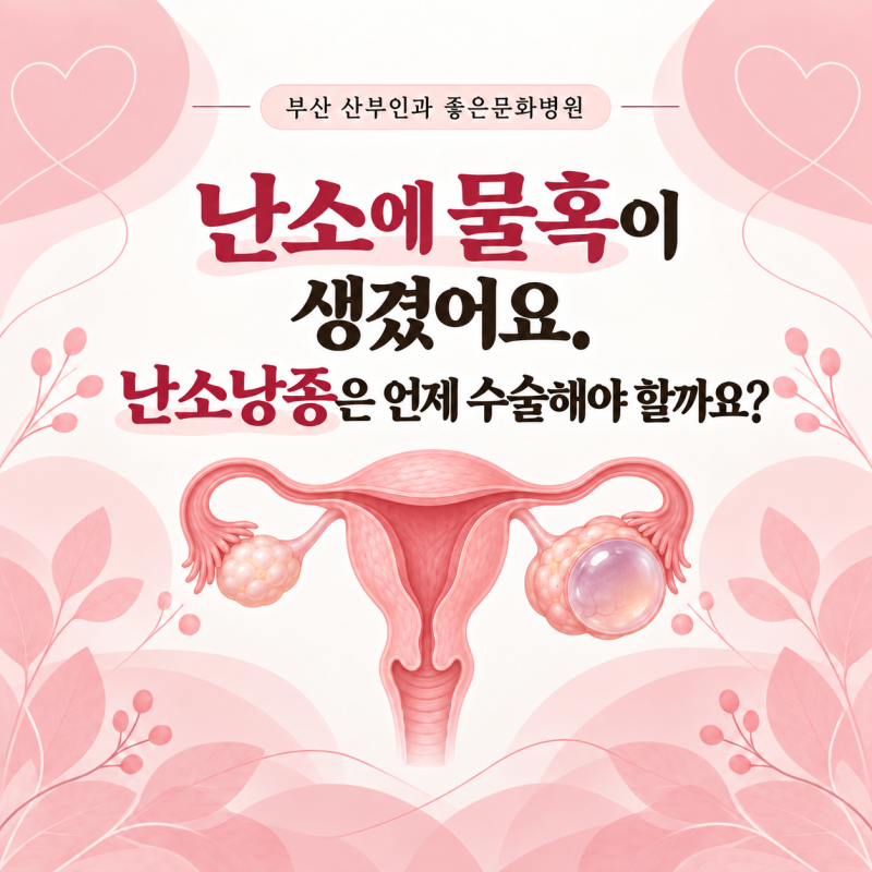 부산 산부인과 좋은문화병원 :: 난소에 물혹이 생겼어요, 난소낭종은 언제 수술해야 할까요?