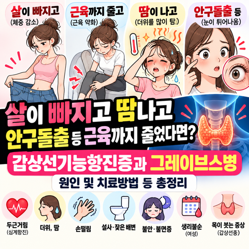 살이 빠지고 땀나고 안구돌출 등 근육까지 줄었다면?갑상선기능항진증과 그레이브스병 원인....