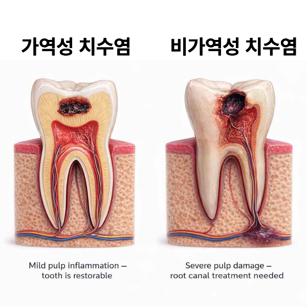 듣기만 해도 어려운 신경치료, 몇 번 받아야 할까? 낙양동 치과 와 함꼐 기간과 과정 알아보....