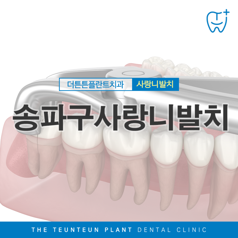송파구사랑니발치, 발치 당일 식사는 어떻게 해야 할까요?