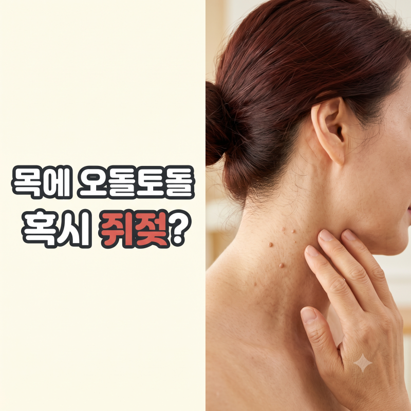 쥐젖제거 손톱깍이로 잘라내도 될까? 목 사타구니 쥐젖 원인