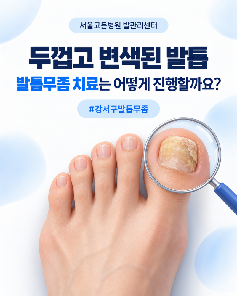 두껍고 변색된 발톱, 서울고든병원 발톱무좀 치료는 어떻게 진행할까요? #증미역발톱무좀