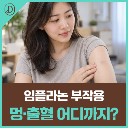임플라논 시술 후 부작용 생겼다면? '이 세 가지' 적어 두세요
