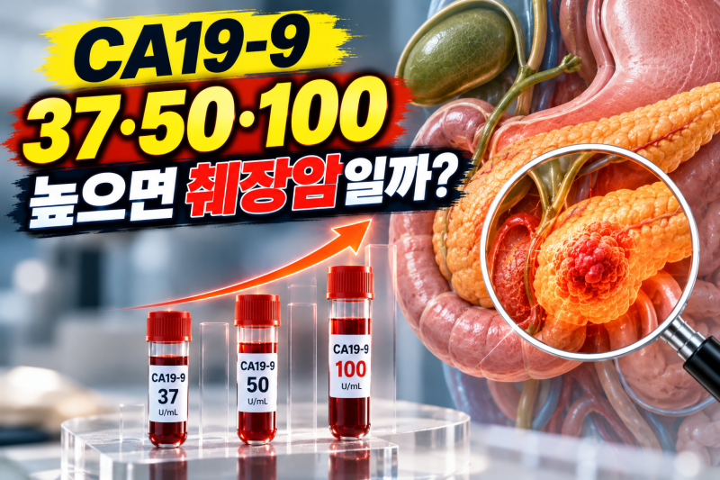 CA19-9 37·50·100 높으면 췌장암일까? 정상수치와 상승 원인 총정리