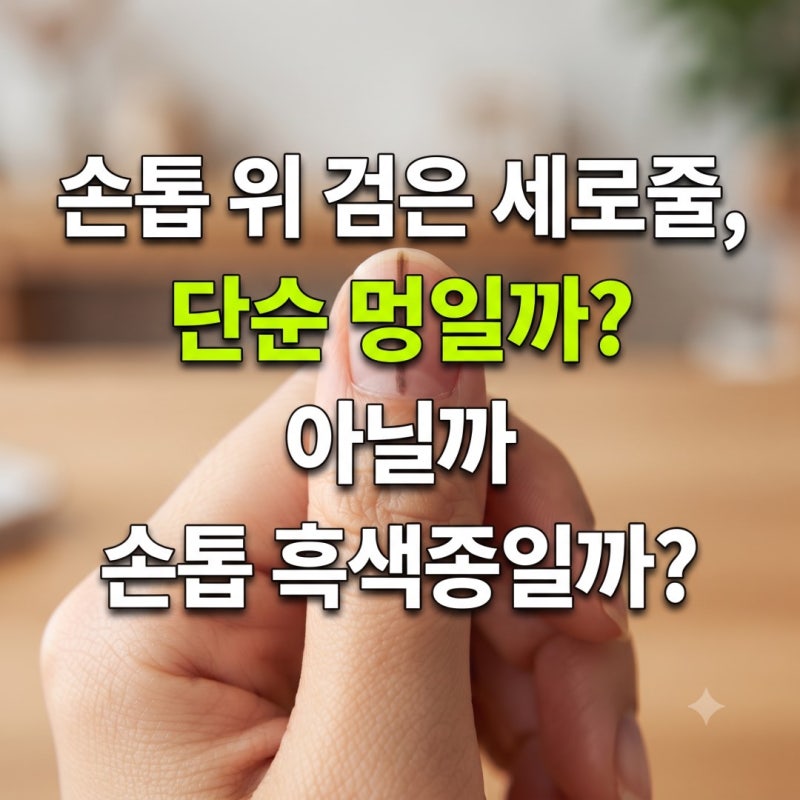 손톱에 생긴 검은 세로줄, 단순 멍일까 아니면 손톱 흑색종일까?