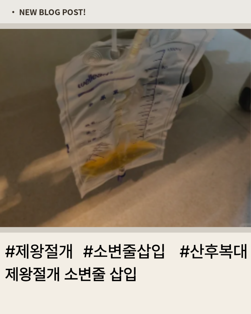 제왕절개 소변줄 삽입부터 빼는 날 첫 화장실까지 솔직 후기
