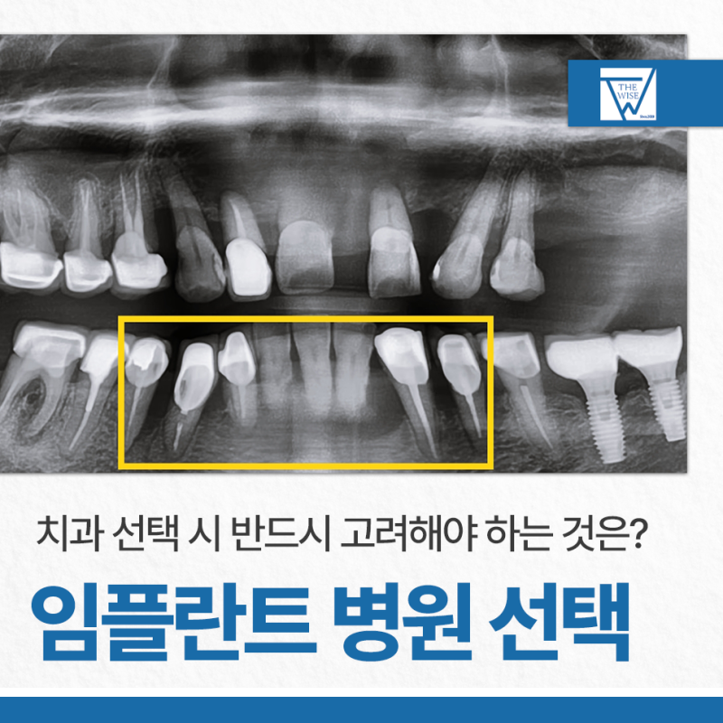 강서구 임플란트 수술 잘하는 병원 찾는다면 이것 주의하세요!