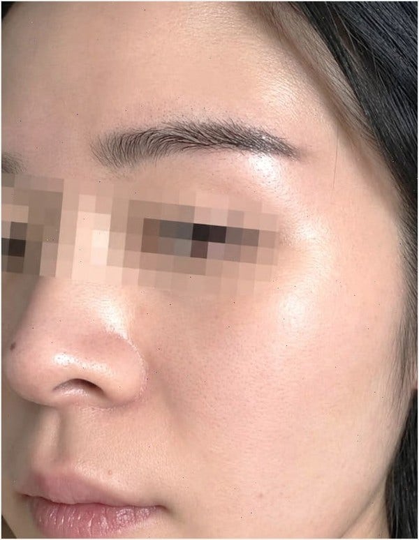 고우리 스킨부스터 가격 두 달 써본 진짜 느낌