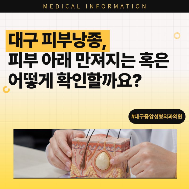 대구 피부낭종, 피부 아래 만져지는 혹은 어떻게 확인할까요?