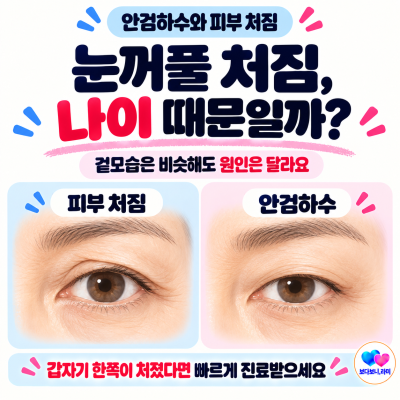 눈꺼풀 처짐 원인 | 안검하수와 단순 노화, 어떻게 구분할까요?