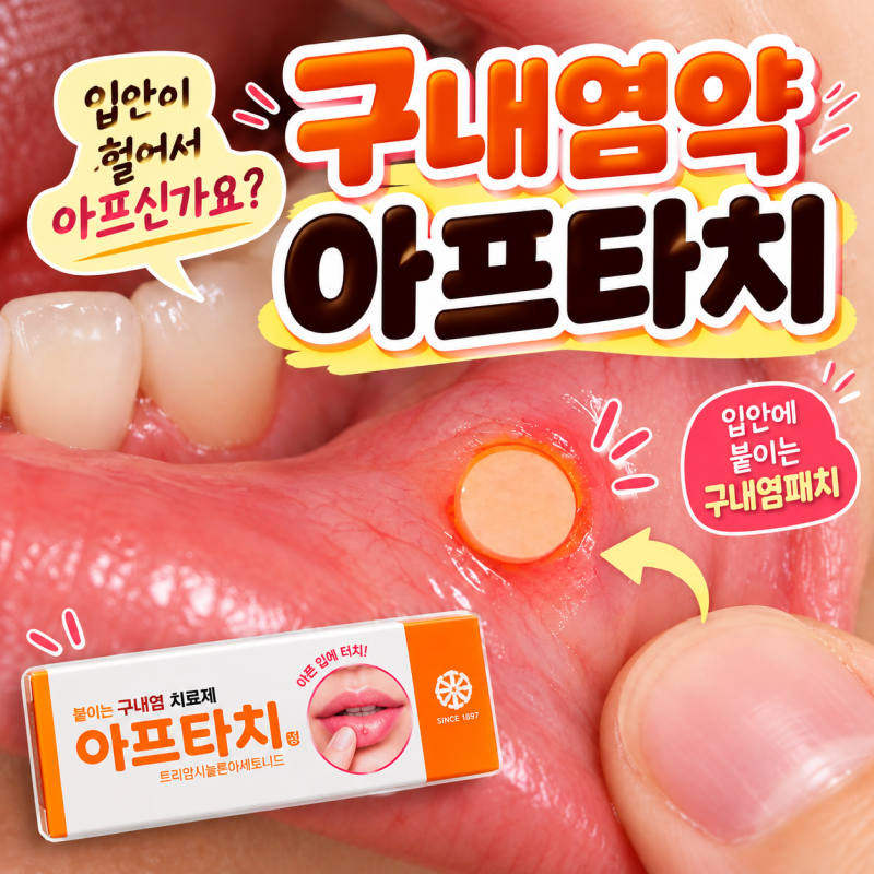 구내염약 아프타치 사용법, 입안구내염에 붙이는 구내염패치 어떻게 사용할까?