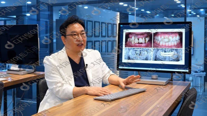 부산임플란트잘하는곳에서 주변 치아 상태도 살펴볼까?