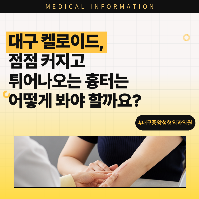 대구 켈로이드, 점점 커지고 튀어나오는 흉터는 어떻게 봐야 할까요?