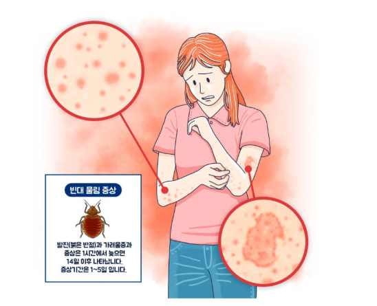 빈대 물린자국 모양, 모기·진드기와 헷갈릴 때 확인하는 법 (약·병원 기준까지)