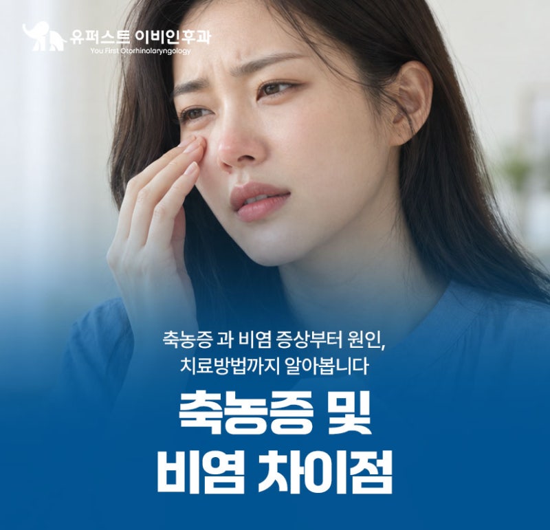 축농증 비염 차이는? 증상 차이, 원인, 치료 방법까지 알아보아요