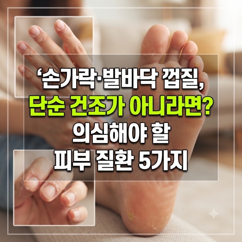 손가락 발바닥 껍질 벗겨짐, 단순 건조가 아니라면 의심해야 할 피부 질환 5가지