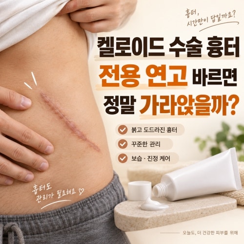켈로이드 수술 흉터 전용 연고 바르면 정말 가라앉을까?