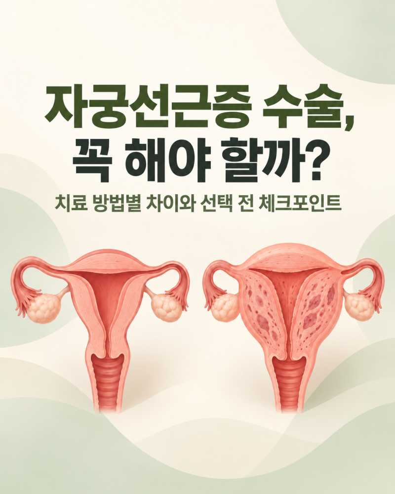 자궁선근증 수술, 꼭 해야 할까? 치료 방법별 차이와 고려할 점