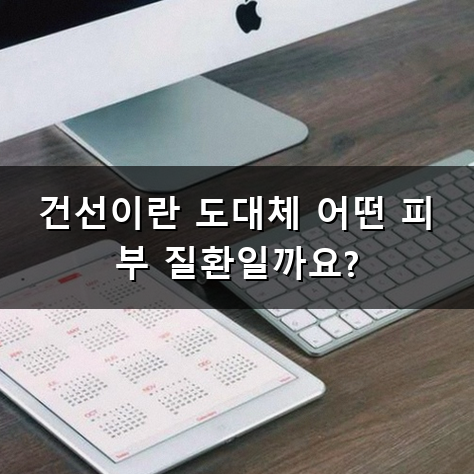 건선 치료 방법 피부에 생긴 붉은 발진과 하얀 각질 대처하는 방법
