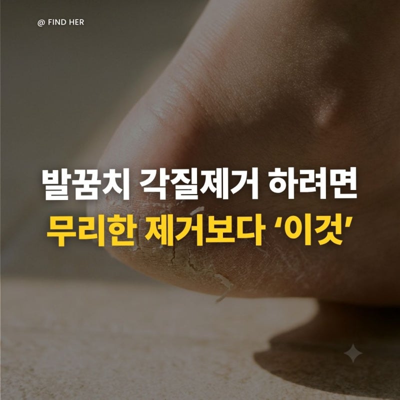 "발뒤꿈치 각질제거하려면" 무리한 제거보다 중요한 '이것'