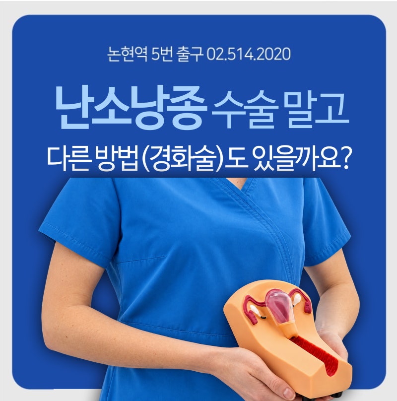 난소낭종 수술 말고 다른 방법 ex 경화술도 있을까요?